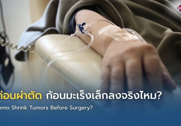 คีโมก่อนผ่าตัด ก้อนมะเร็งเล็กลงจริงไหม?