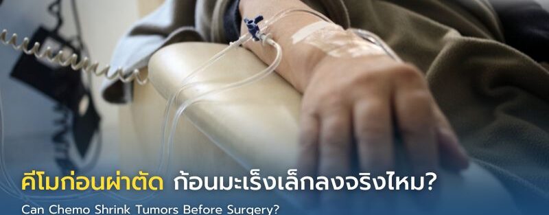 แพทย์อธิบายผลตรวจและการให้คีโมก่อนผ่าตัดเพื่อช่วยลดขนาดก้อนมะเร็งแก่ผู้ป่วย