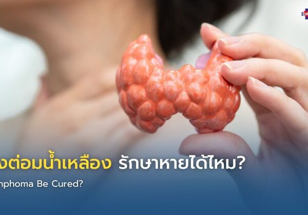 มะเร็งต่อมน้ำเหลือง รักษาหายได้ไหม?