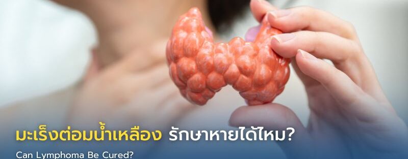 ผู้ป่วยปรึกษาแพทย์เกี่ยวกับโอกาสรักษามะเร็งต่อมน้ำเหลือง พร้อมภาพจำลองระบบต่อมน้ำเหลืองภายในร่างกาย