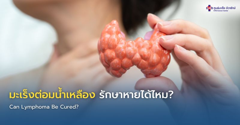 ผู้ป่วยปรึกษาแพทย์เกี่ยวกับโอกาสรักษามะเร็งต่อมน้ำเหลือง พร้อมภาพจำลองระบบต่อมน้ำเหลืองภายในร่างกาย